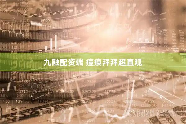 九融配资端 痘痕拜拜超直观